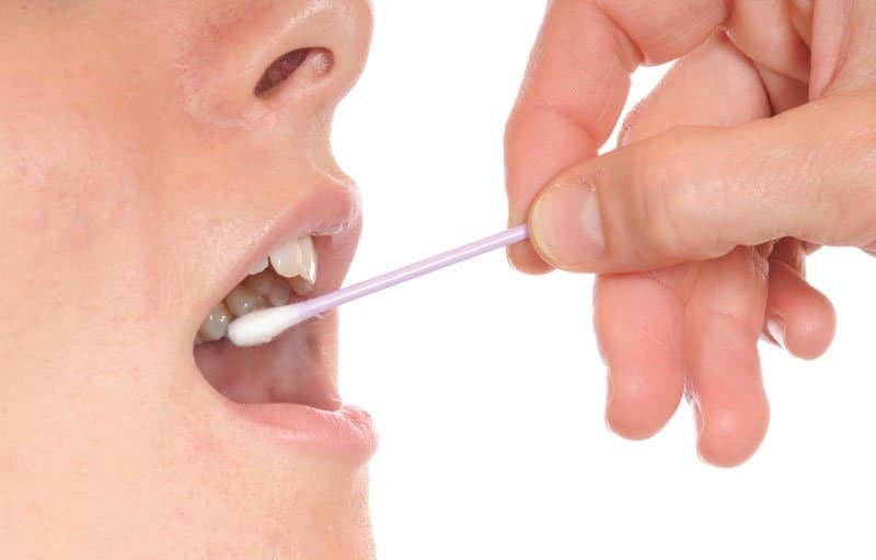 Buccal Cheek swab pic
